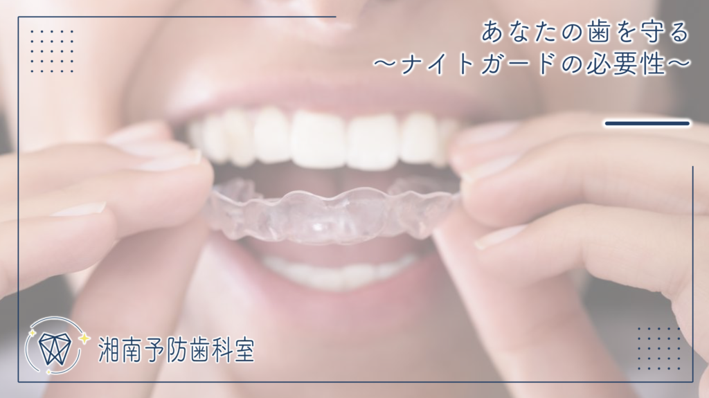 あなたの歯を守る~ナイトガードの必要性~