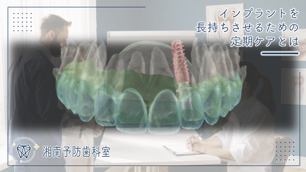 インプラントを長持ちさせるための定期ケアとは